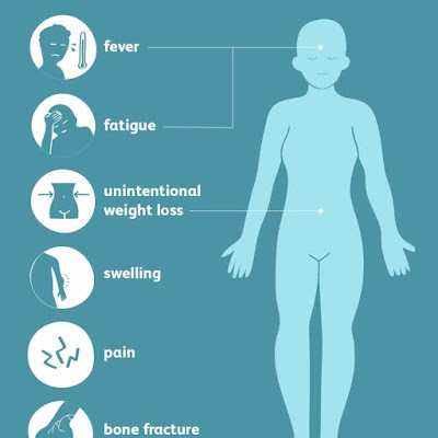 symptoms of bone cancer