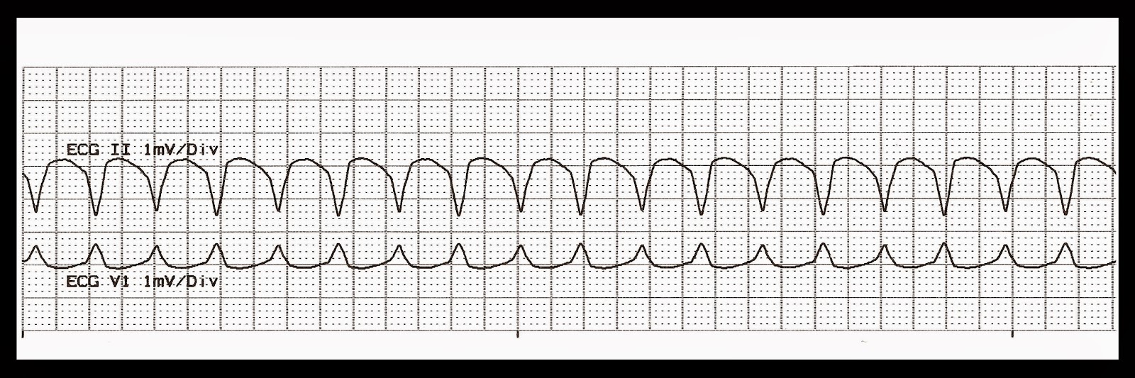 Practice EKG Strips 395