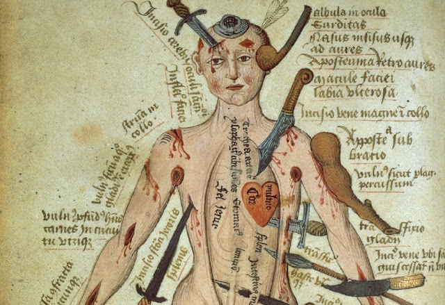 Medieval people made illustrations to explain medical and anatomical issues of human body. Средневековые люди делали иллюстрации, чтобы объяснить медицинские и анатомические проблемы человеческого тела. 