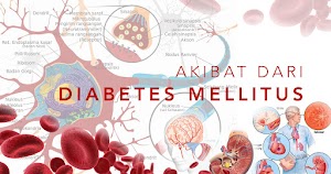 Jual ALGA GOLD CEREAL Obat Herbal Diabetes Ampuh Di Sigi | WA : 0822-3442-9202