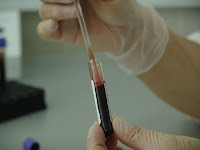 Blood Test, public domain image via Pixabay