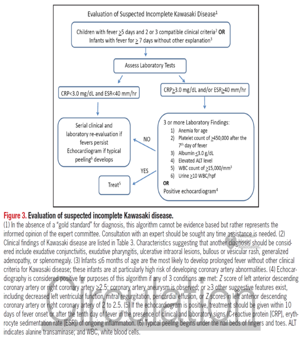 Pedi cardiology Kawasaki Syndrome Algorithm for diagnosis