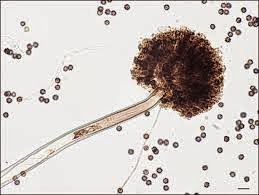 Gambar Dunia Bioteknologi Rhizopus Oryzae Gambar Jamur