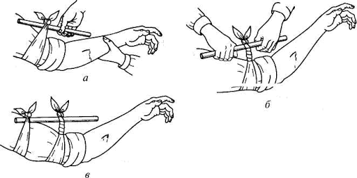 Как сделать жгут на шею. Смотреть фото Как сделать жгут на шею. Смотреть картинку Как сделать жгут на шею. Картинка про Как сделать жгут на шею. Фото Как сделать жгут на шею Как сделать жгут на шею. Смотреть фото Как сделать жгут на шею. Смотреть картинку Как сделать жгут на шею. Картинка про Как сделать жгут на шею. Фото Как сделать жгут на шею