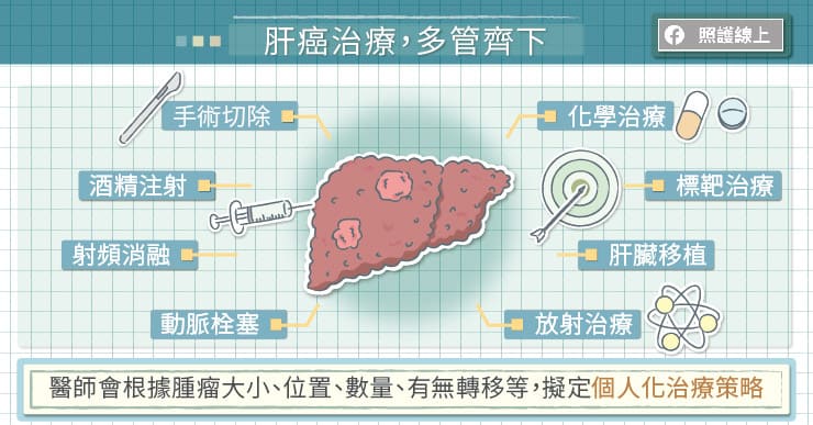 肝癌治療