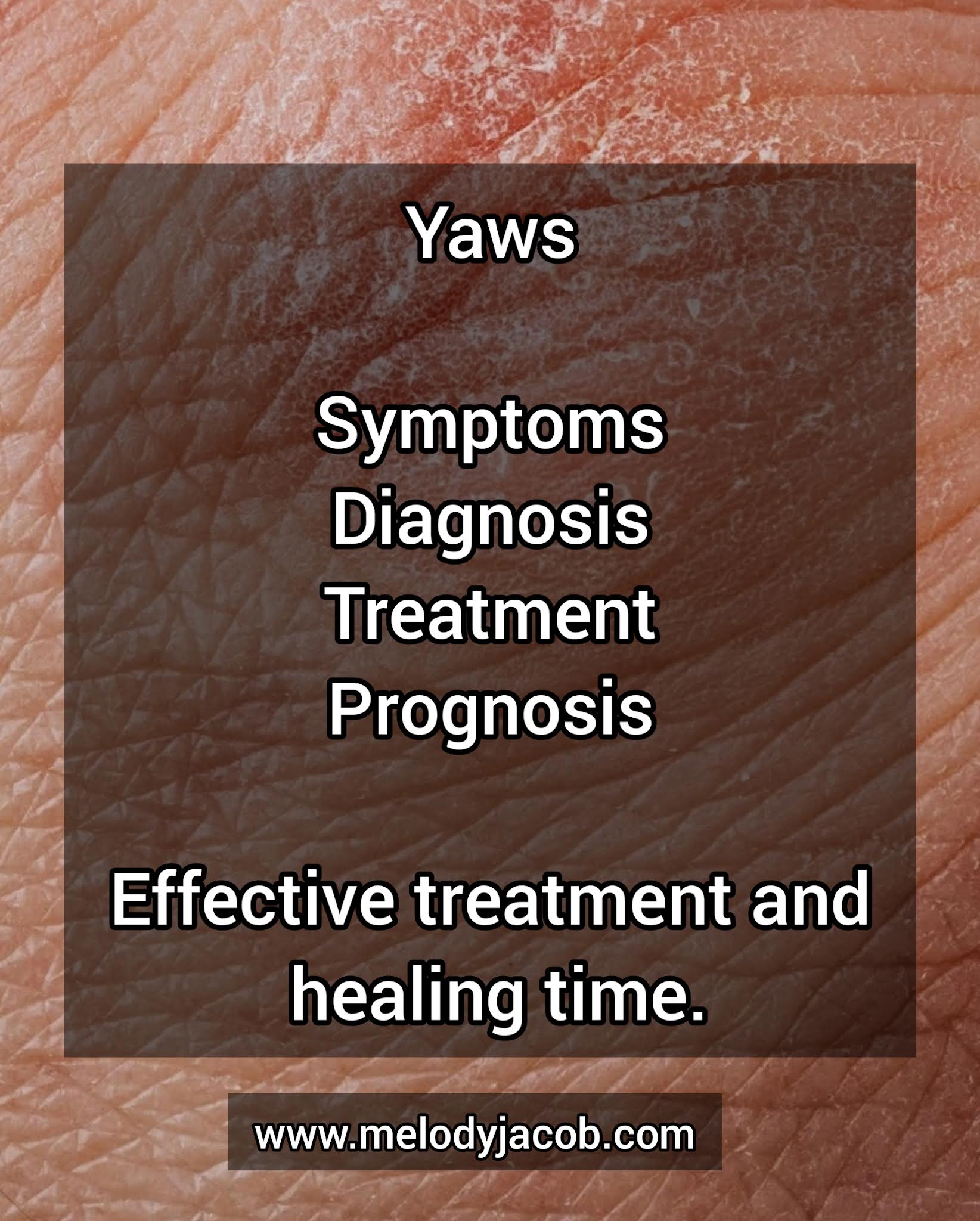Yaws Diagnosis, Prevention and Treatment. MÉLÒDÝ JACÒB