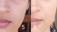 Re'equil Skin Radiance Cream Review Re'equil Skin Radiance Cream for pigmentation Review