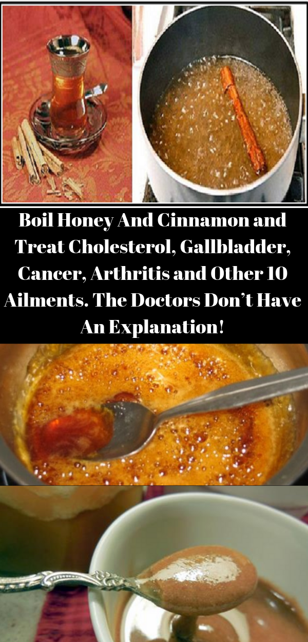 Boil Honey And Cinnamon and Treat Cholesterol, Gallbladder, Cancer