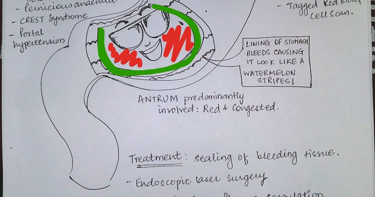 Medicowesome Watermelon stomach GAVE!