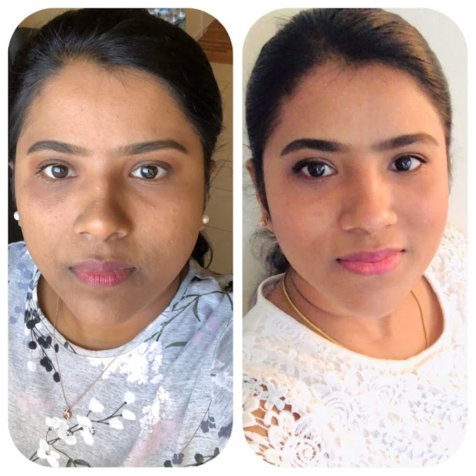 How I Removed Darkspot,Pigmentation,Mole,dark circle from my face