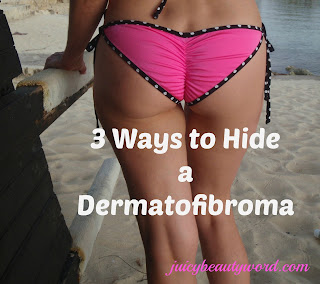 3 ways to hide a dermatofibroma