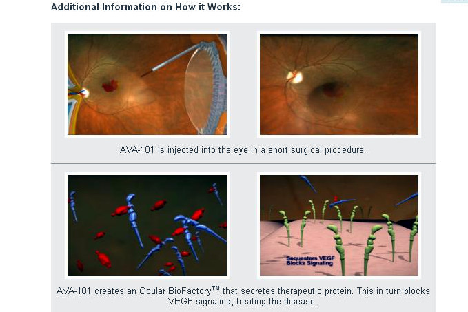 Irv Arons' Journal: A Novel Gene Therapy Approach to Treating the Wet ...