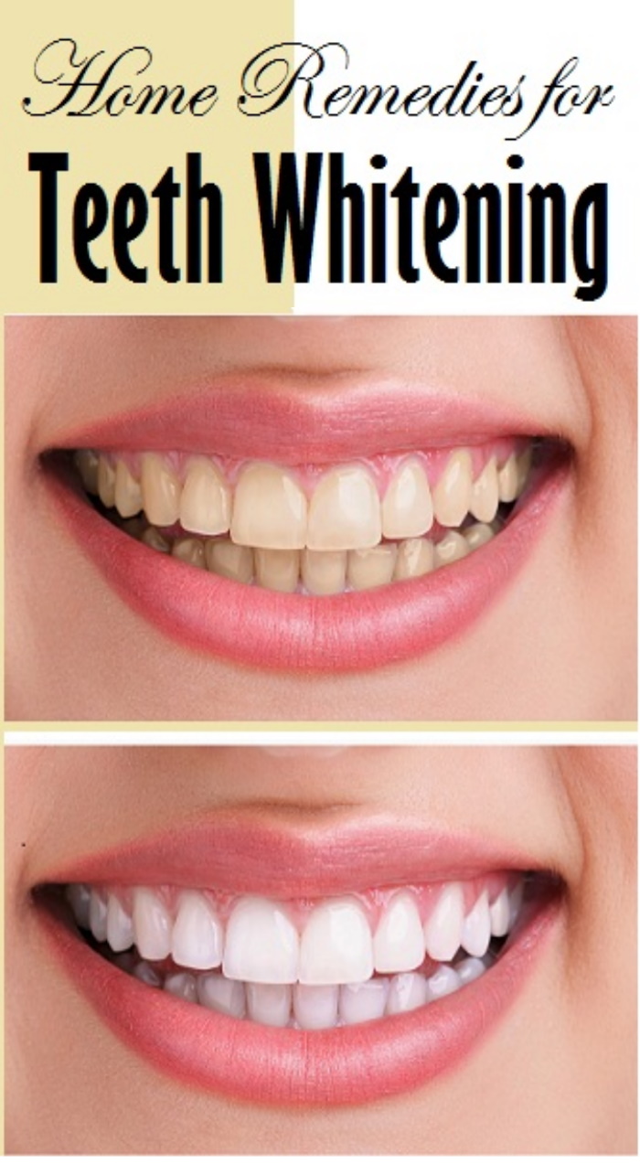 Best Home Remedies for Teeth Whitening wellness magazine