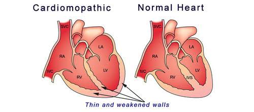 diabetes and heart disease symptoms