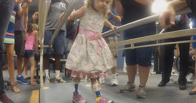 Ireland Nugent walks on her new prosthetic legs on June 17, 2013. WTSP.COM