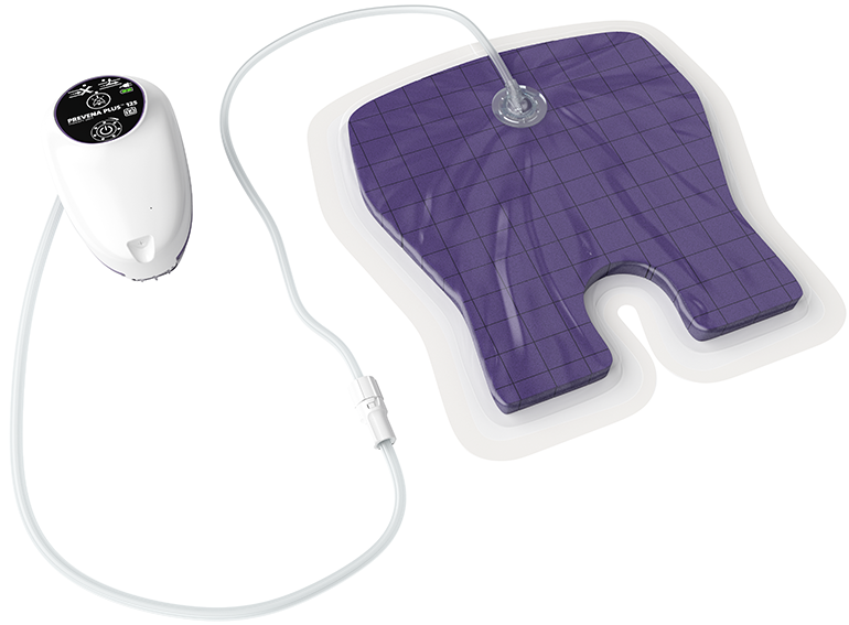 Terapia de presión negativa para heridas