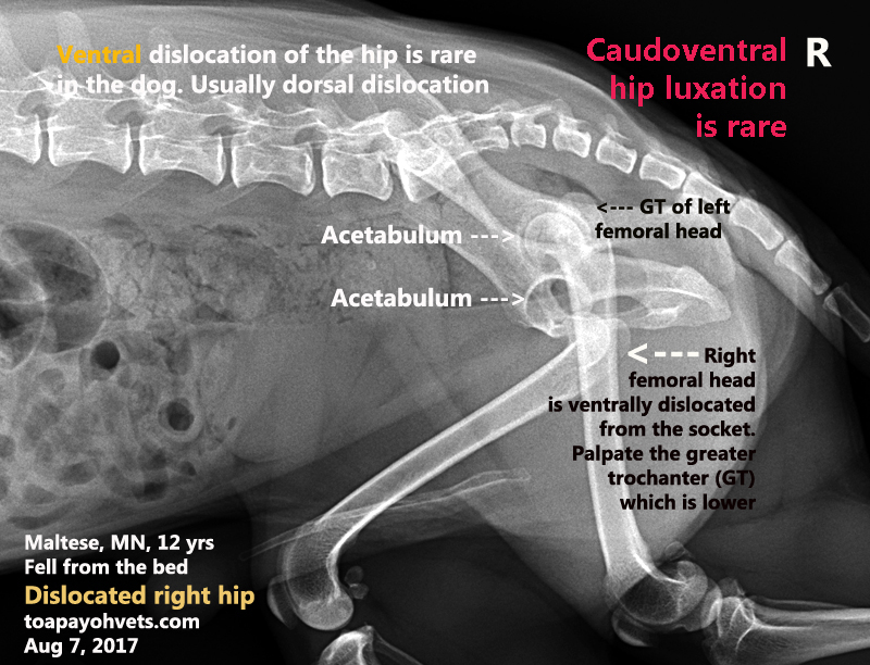 2010vets 3116. A 12yearold Maltese fell from the bed and dislocated his right hip. A rare