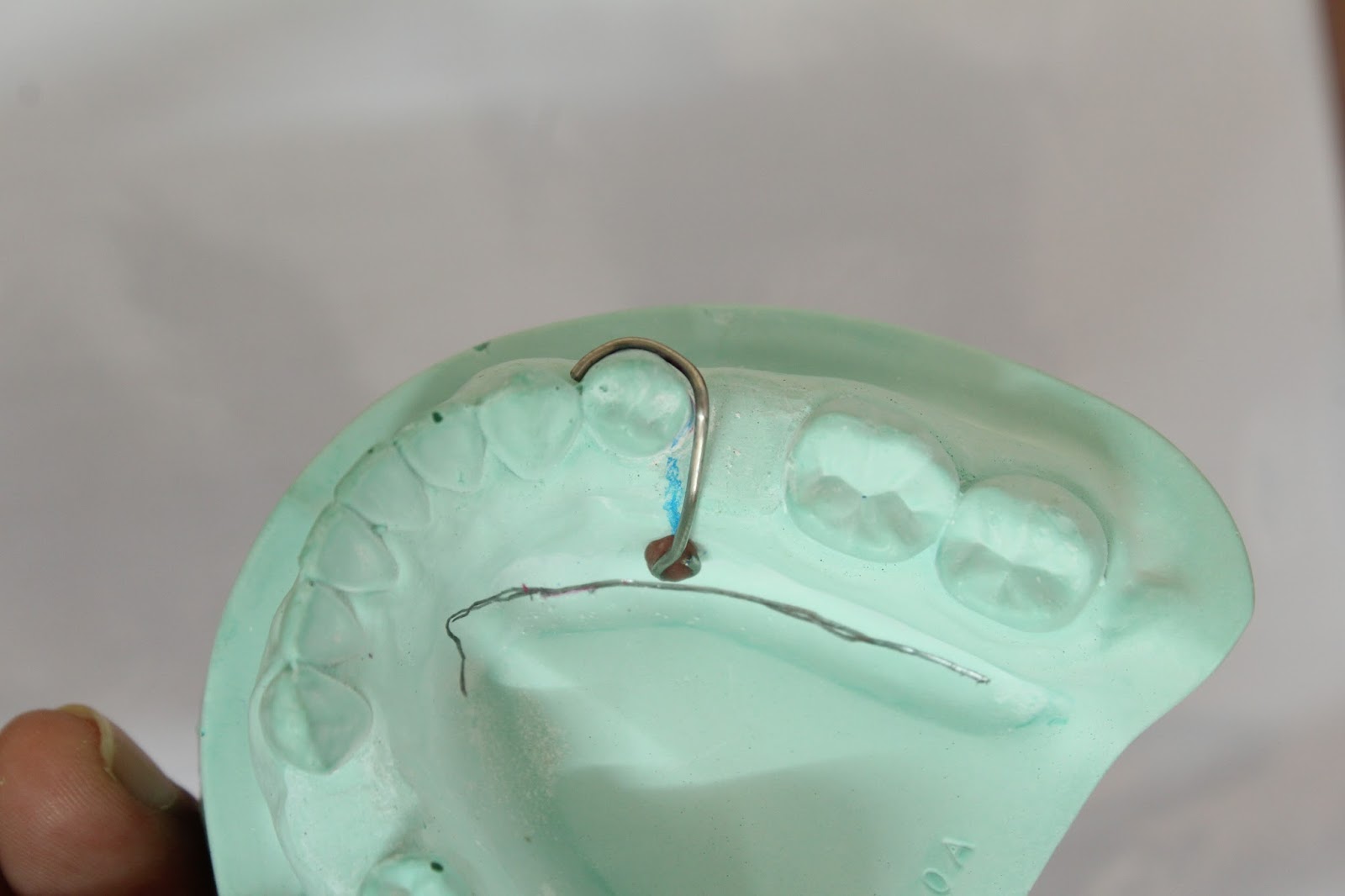 Step by step Guide for Understanding the Prosthodontics Making clasp