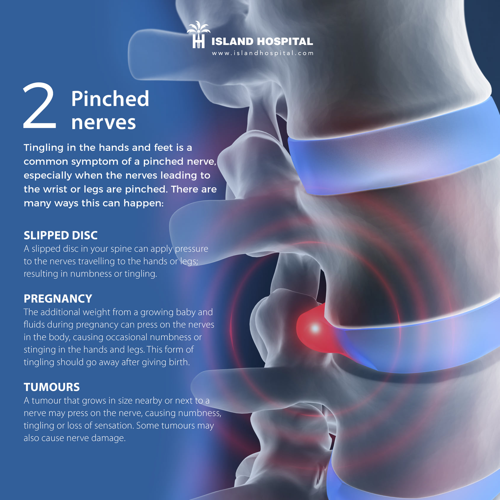 National Cancer Society of Malaysia, Penang Branch Why Are My Hands