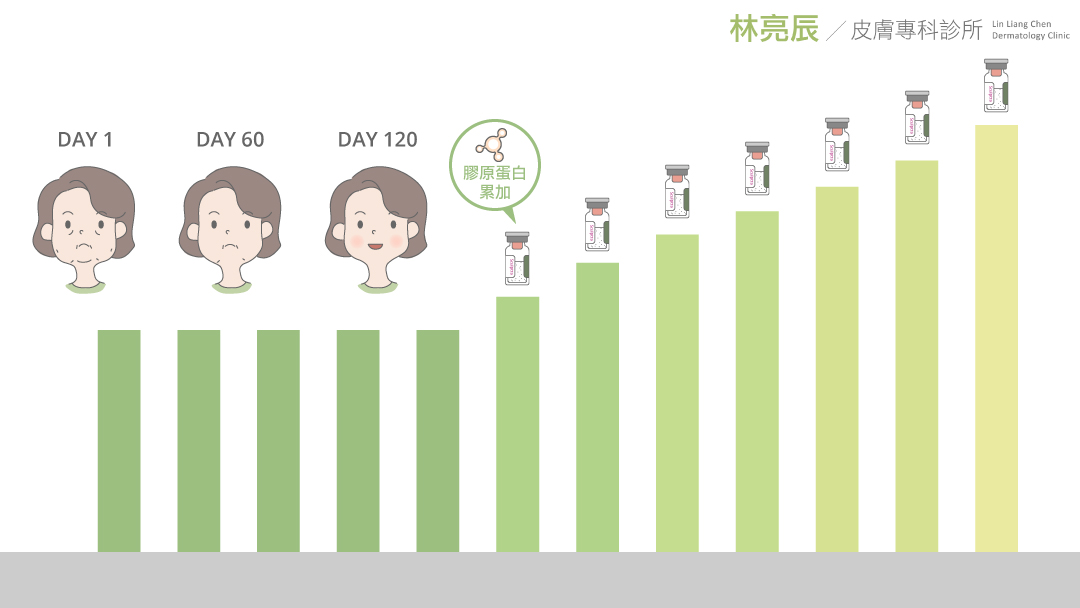 3D聚左旋乳酸sculptra舒顏萃液態拉皮童顏針打多少CC費用多少錢價格新竹林亮辰醫師林亮辰皮膚專科診所複利效應4