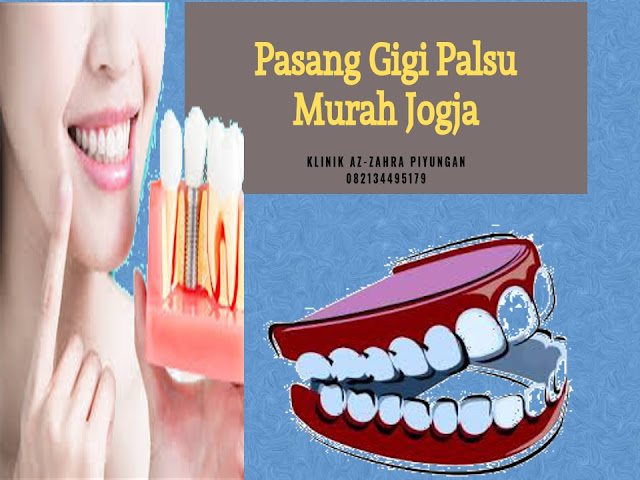 12+ Mimpi Pasang Gigi Palsu Togel