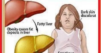 liver fatty reverse