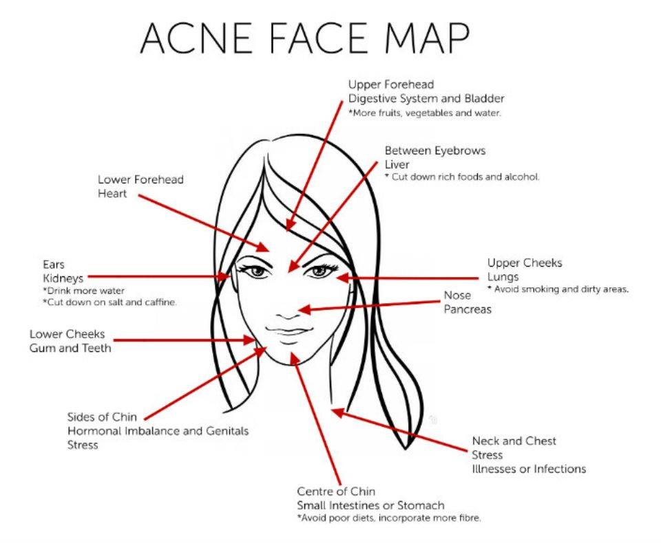 Healthy Living Blog Associated Causes and solutions of Acne per Facial