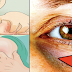 8 Early Symptoms and Signs That Your Blood Sugar Levels Is Too High Can Lead To Serious Health Problem