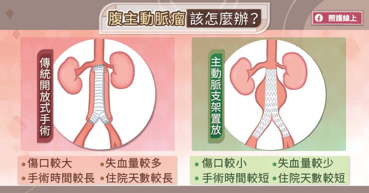 積極治療，預防主動脈瘤破裂