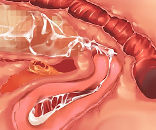 [CG] My Yandere Sister loves me too much!