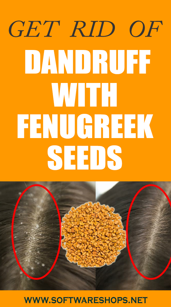 Get rid of dandruff with fenugreek seeds