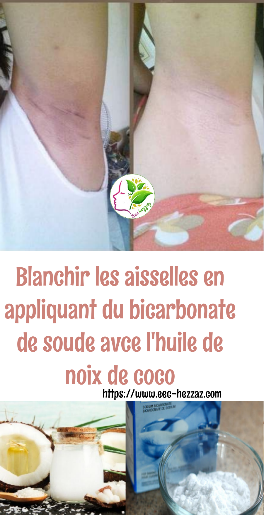 Blanchir les aisselles en appliquant du bicarbonate de soude avce l'huile de noix de coco