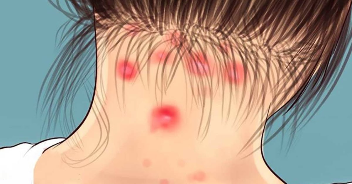 Fibromyalgia Makes Us Tired And Gives Joint Pain 8 Fibromyalgia Makes Us Tired And Gives Joint Pain 8