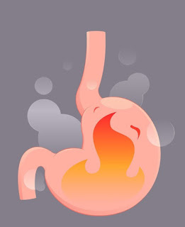 Is Avocado Good or Bad for Acid Reflux? Is Avocado Good or Bad for Acid Reflux?