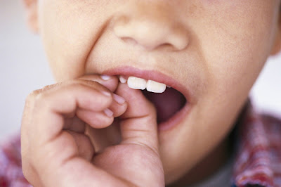 Lưu ý khi nhổ răng sữa cho trẻ em