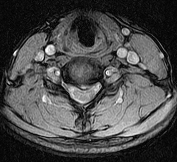 Acupuncture and Rehabilitation ( Road to full recovery) Korean