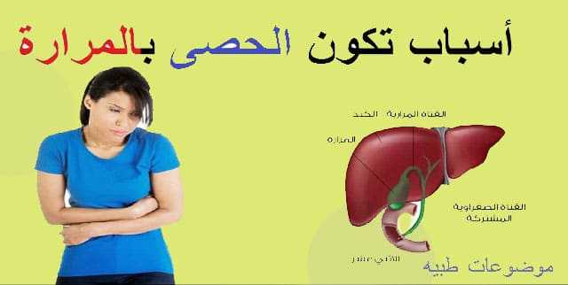 أسباب حصوات المرارة أسباب لم يتم ذكرها من قبل