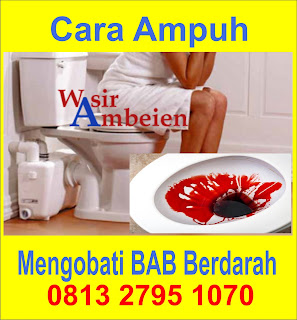 Obat Ambeien Internal Bengkak Bab Berdarah Paling Ampuh