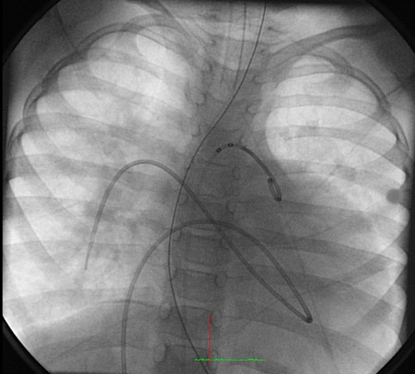 PediCardiology Quiz Quiz 20 Cardiac Catheterization