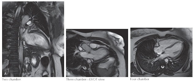 MRI can generate images of the heart in multiple user-defined orientation. LVOT, Left ventricular outflow tract.