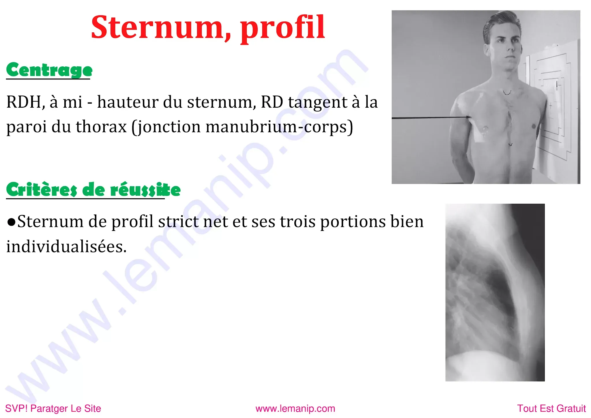 Sternum de profil