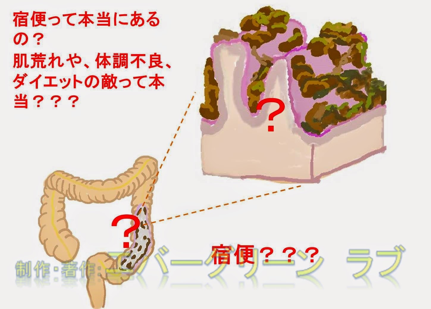 宿便 Fecal Impaction Japaneseclass Jp