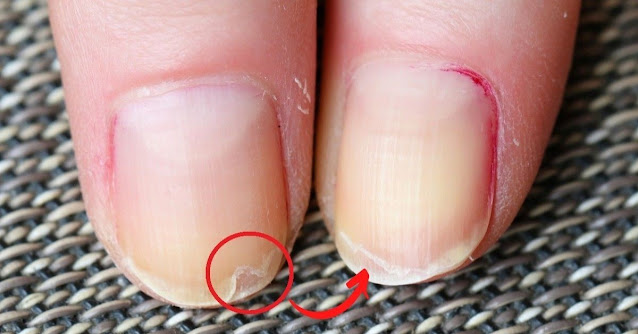 Ongles cassants? Que faire pour les renforcer?