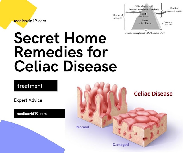 Secret Home Remedies To Cure Celiac Disease