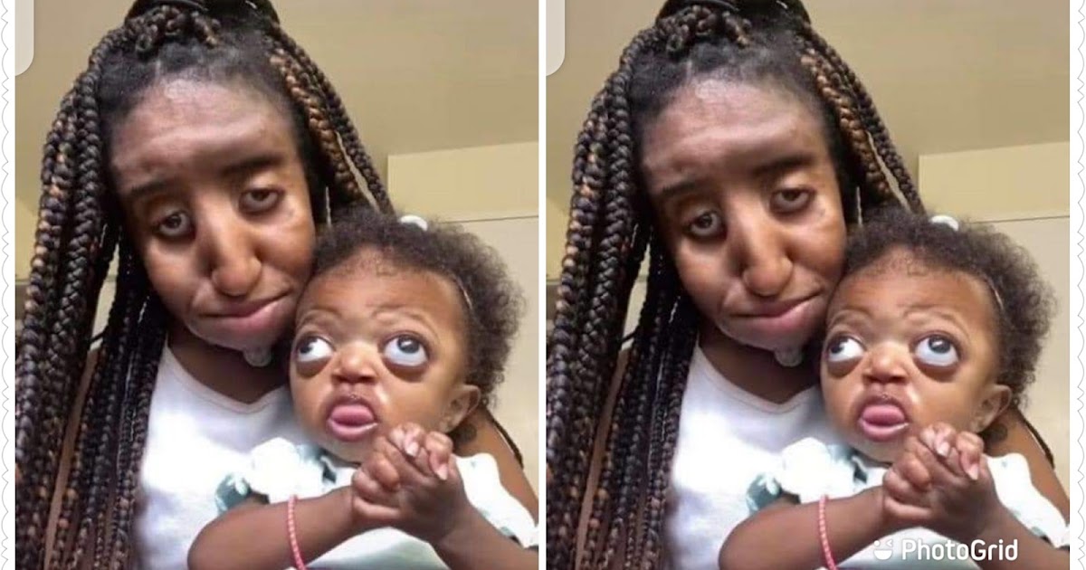 Today is my daughter birthday, I know both of us are ugly and have a medical disorder please wish her well