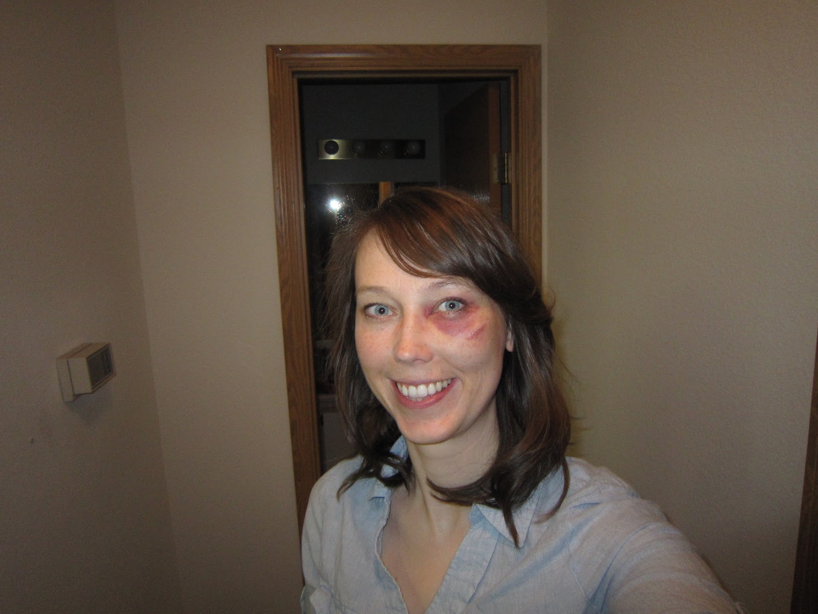 befuddled bug's blog of bewilderment My First Black Eye!!!