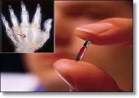 ALERTAS: Personas En Suecia Se Han Implementado Chips En Sus Cuerpos. ALERTAS: Personas En Suecia Se Han Implementado Chips En Sus Cuerpos.