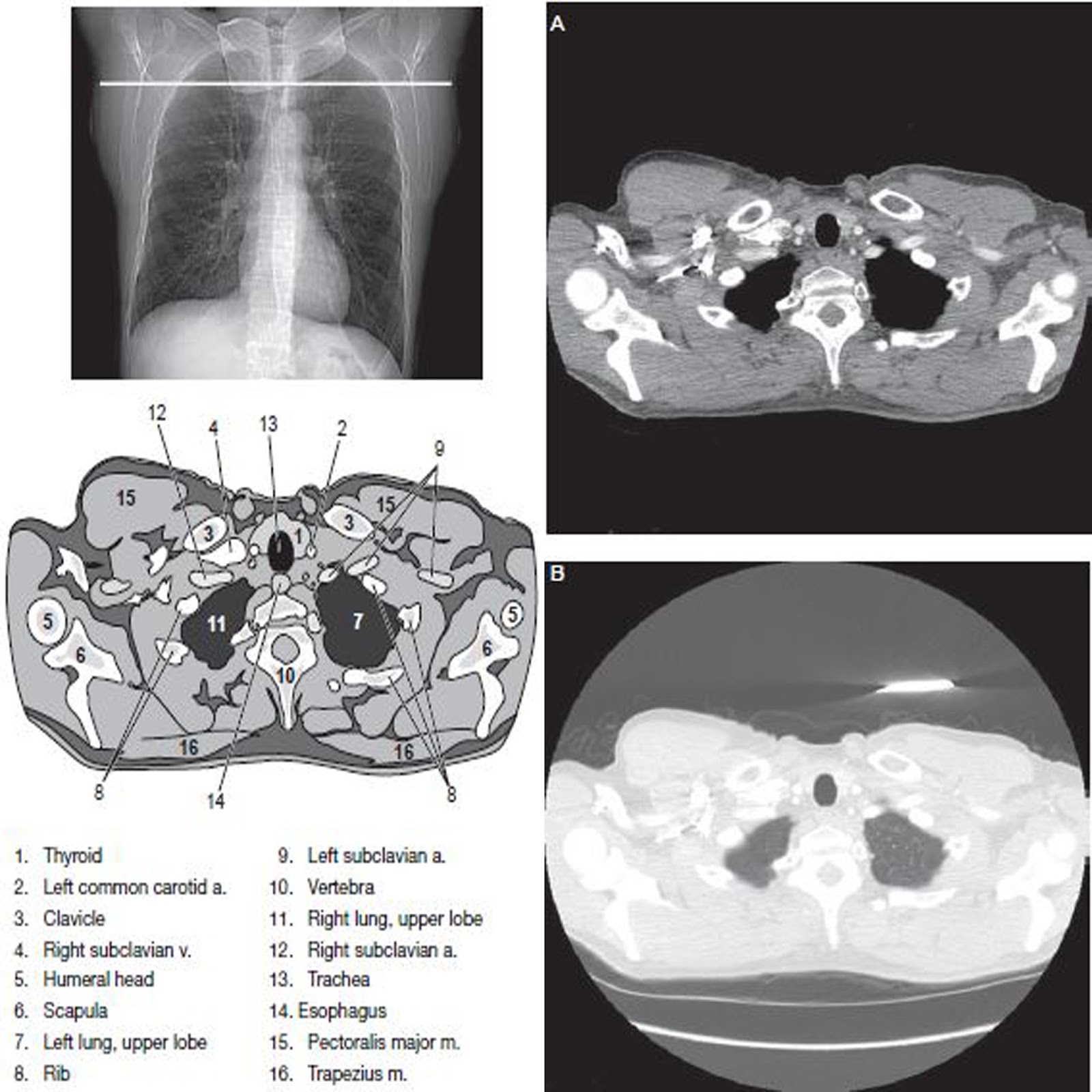 Chest CT Scan Imaging - RadTechOnDuty