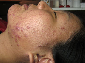 Yun Shock Blog: Good food = Good skin (part 1)