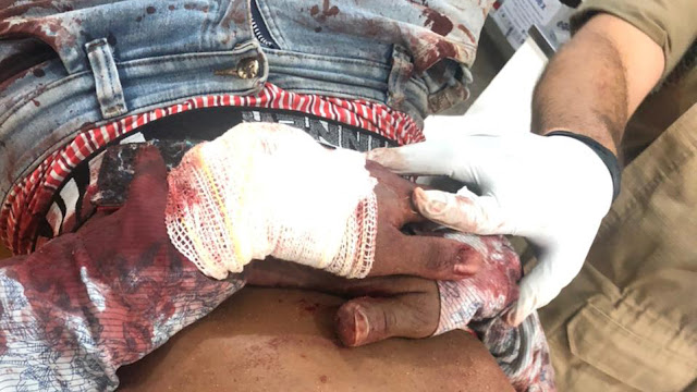 Comerciante reage a assalto, mata um criminoso e manda outro pro hospital em Ji-Paraná